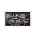 AG Neovo LCD 21 5i FHD 1920x1080 Dental
