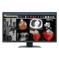 Eizo Radiforce MX317W